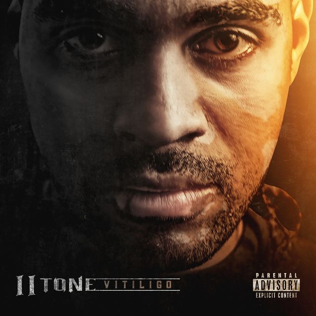 Ii Tone - 'Vitiligo' [Ringtone]