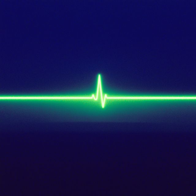 STXPH - 'Low Pulse' [Ringtone]