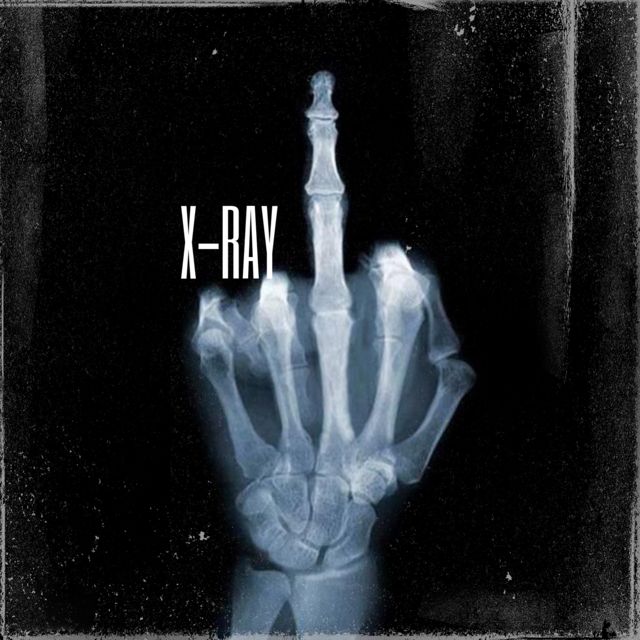 Sizwe Meshack - 'X Ray' [Ringtone]