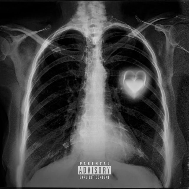 Scotty Iv - 'Heart Emoji' [Ringtone]