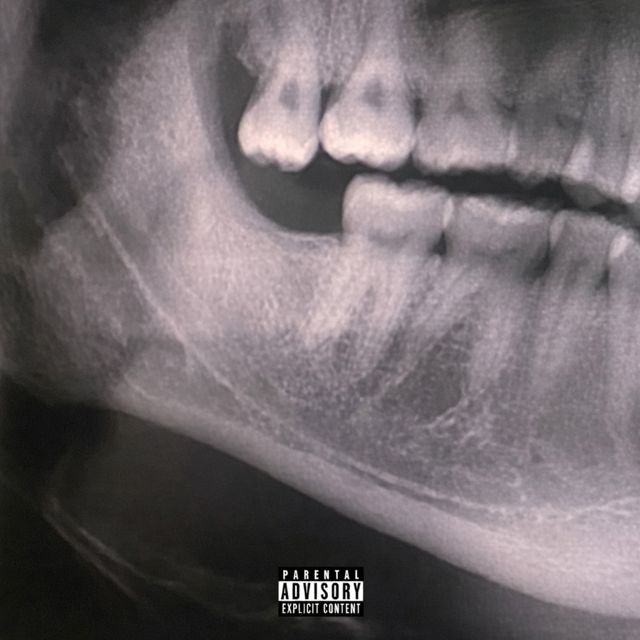 moshpit love - 'dip & slide' [Ringtone]