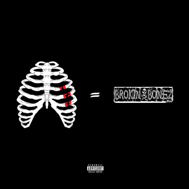 Lazer Dim 700 - 'brokin bonez' [Ringtone]