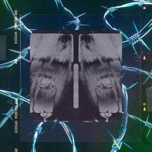 OVRTME - 'Aurora' [Ringtone]