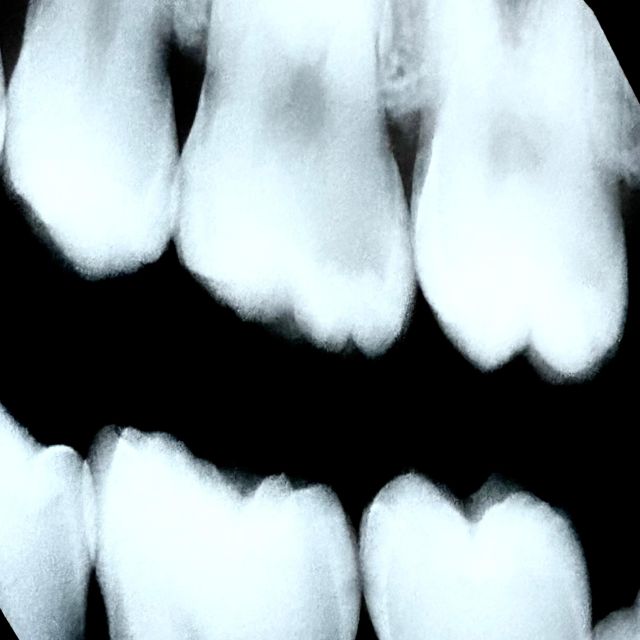Shlumpy - 'it's ok' [Ringtone]