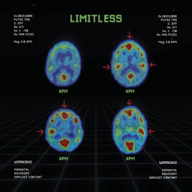 Xpm - 'Limitless' [Ringtone]