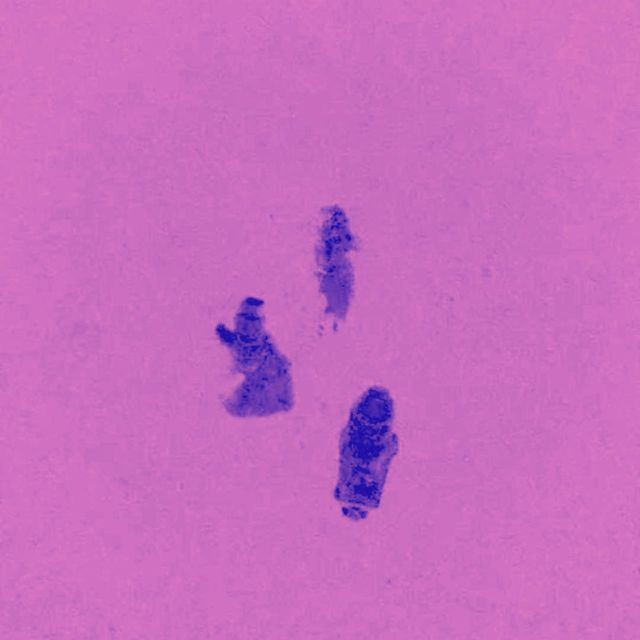 yacø - 'No sé' [Ringtone]