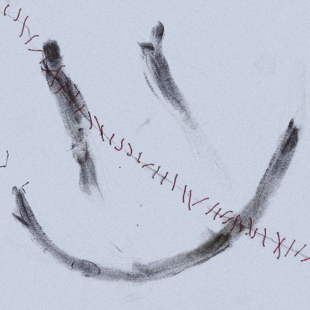 Marcosa - 'Cicatrices' [Ringtone]